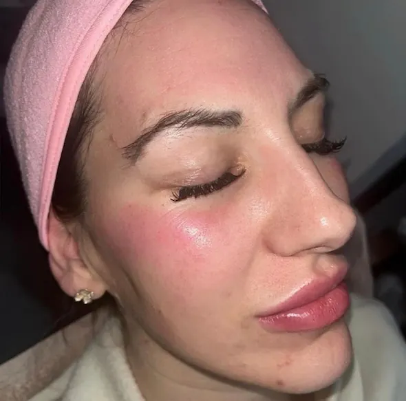 Restorative Facial